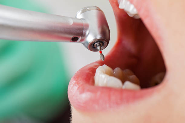 Best Cracked Tooth Emergency Dentist  in West Belmar, NJ